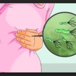 Como se Cura la Gastritis Bacteriana